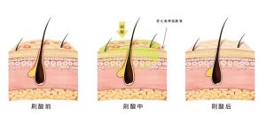 日常护肤用“酸”居然有这么多讲究